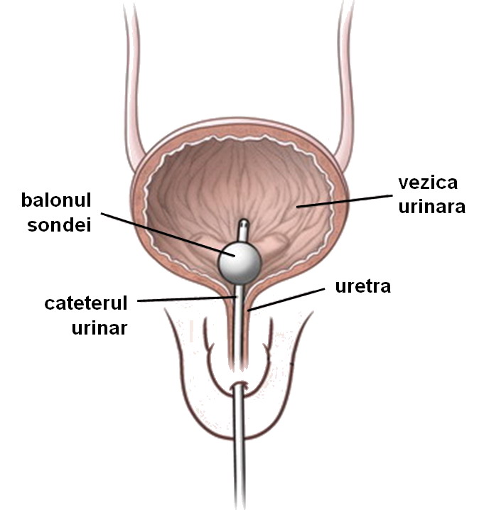 de ce doare vezica urinara la barbati remediu eficient pentru prostatită și adenom de prostată